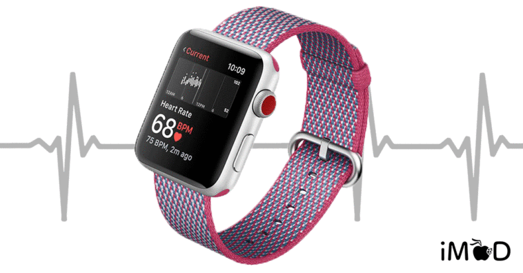 Future Feature Apple Watch Ekg Heart Monitor