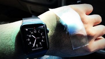 Apple Watch Detect Abnormal Heart Rhythms Cover