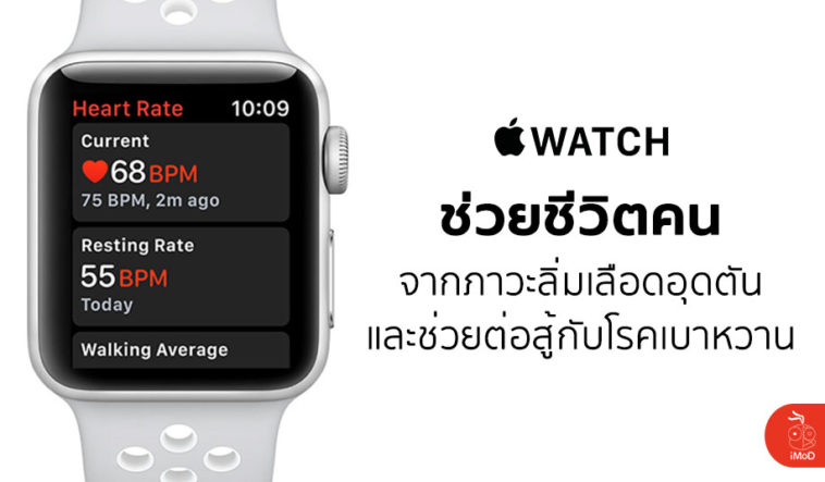 Apple Watch Save Life Blood Clots