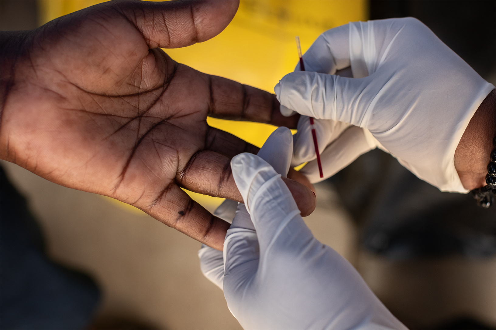 Red And Global Fund Nairobi Blood Testing 11292018