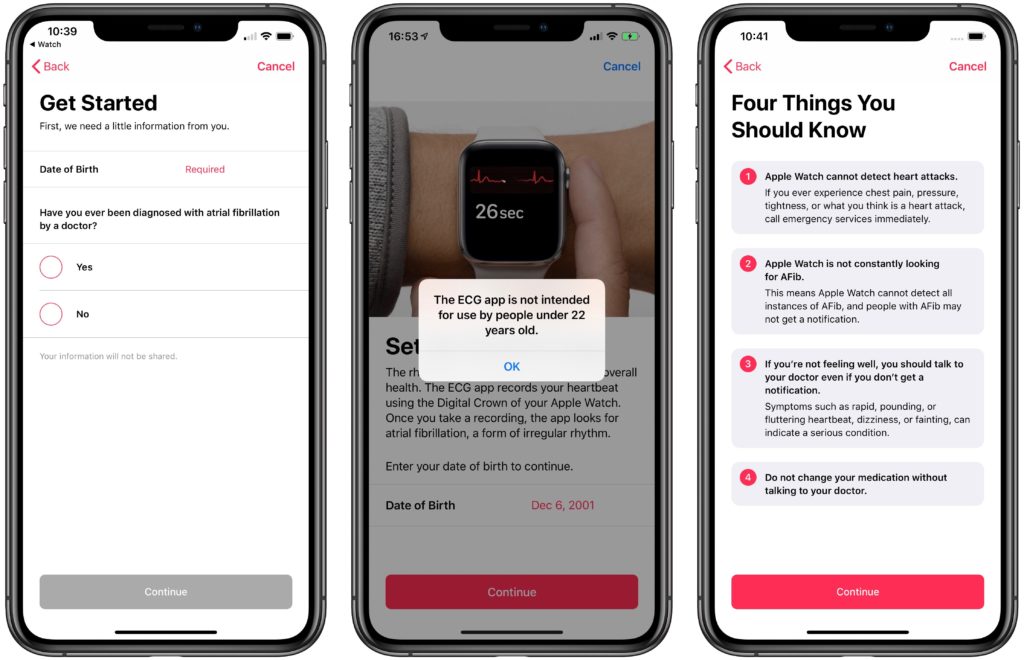 Ecg Feature Age Restriction 1