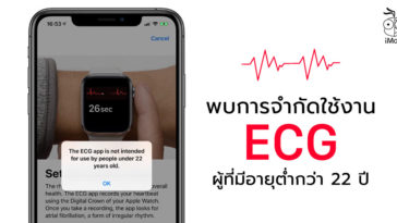 Ecg Feature Age Restriction