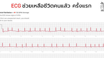 Ecg Feature Apple Watch Series 5 Save Life First Time