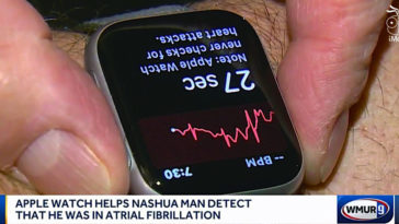 Apple Watch Series 4 Ecg Detect Patient Afib