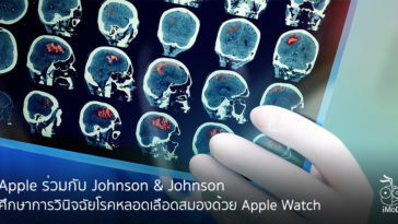 Johnson And Johnson Study With Apple For Detect Stroke From Apple Watch