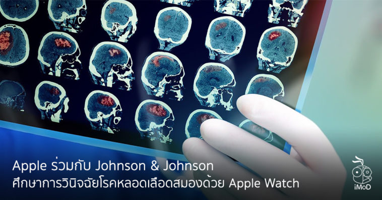 Johnson And Johnson Study With Apple For Detect Stroke From Apple Watch