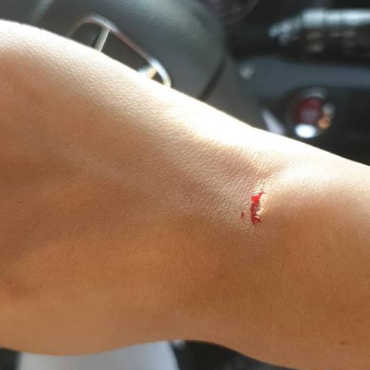 Apple Watch Series 2 Swollen Battery Thai Woment 3