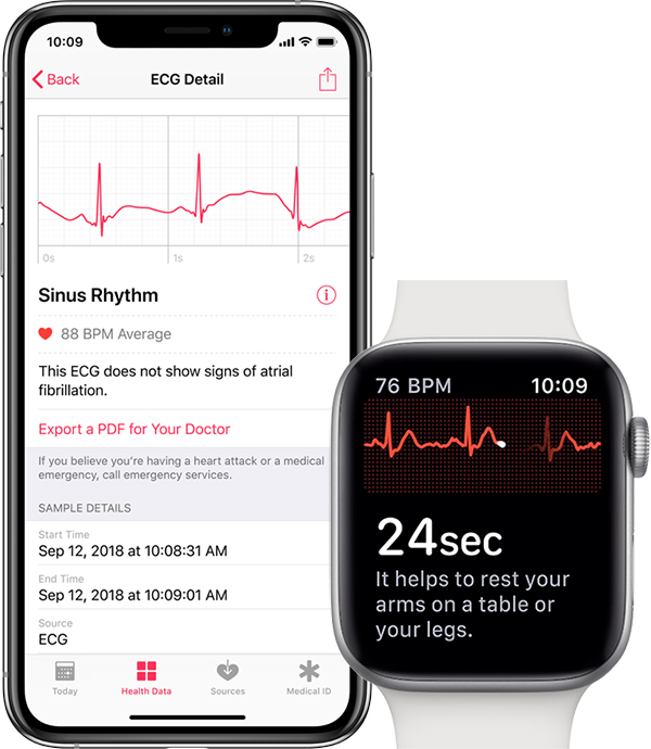 Iphone Apple Watch Ecg