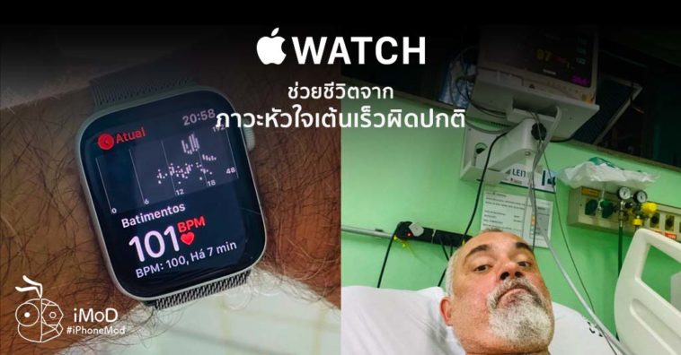 Apple Watch Save Brazil Man Life From Tachycardia