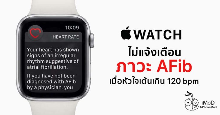 Apple Watch Not Defect Afib If Heart Rate Over 120 Bpm