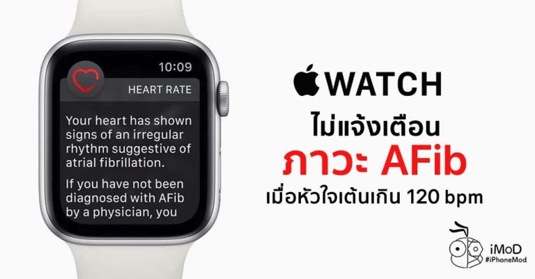 Apple Watch ไม่พบภาวะหัวใจสั่นพลิ้ว (AFib) เมื่ออัตราการเต้นของหัวใจสูง